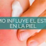 Los síntomas de ansiedad en la piel: ¿Cómo afecta a nuestro cuerpo?